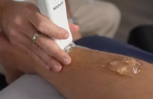 What are the benefits of MSK Ultrasound?